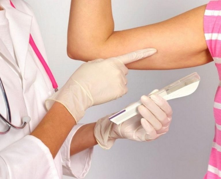 Implante contraceptivo